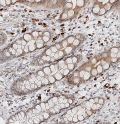 ZNF678 Antibody - BSA Free