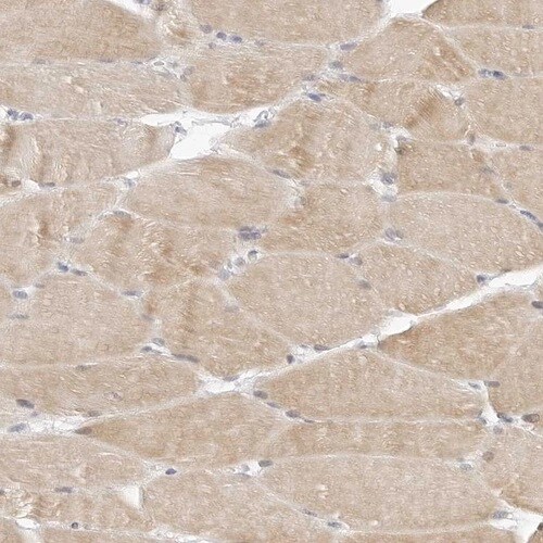 TSEN2 Antibody - BSA Free Immunohistochemistry-Paraffin: TSEN2 Antibody [NBP1-81141]