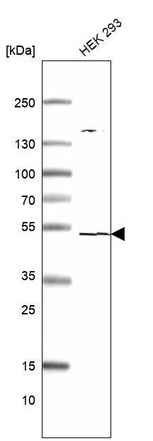 TSEN2 Antibody - BSA Free Western Blot: TSEN2 Antibody [NBP1-81141]