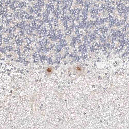 TSEN2 Antibody - BSA Free Immunohistochemistry-Paraffin: TSEN2 Antibody [NBP1-81141]