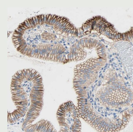TMIGD2 Antibody
