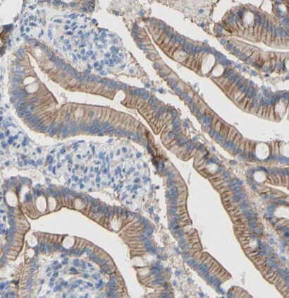 TMIGD2 Antibody