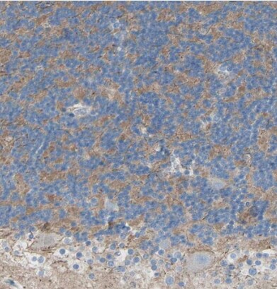 TMIGD2 Antibody
