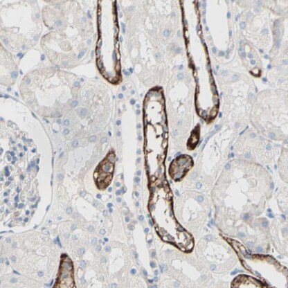TMIGD2 Antibody