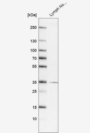 TMIGD2 Antibody