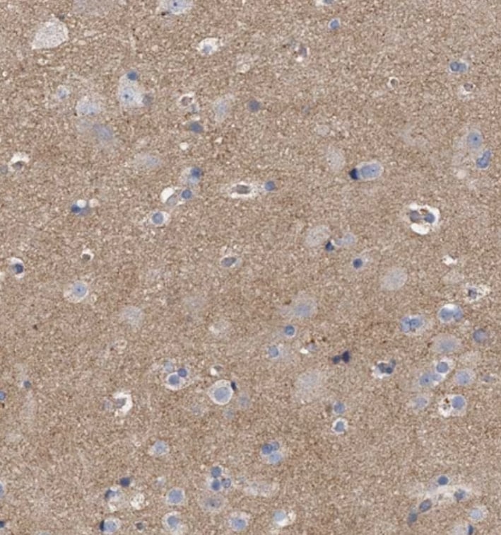 MAMDC2 Antibody - BSA Free