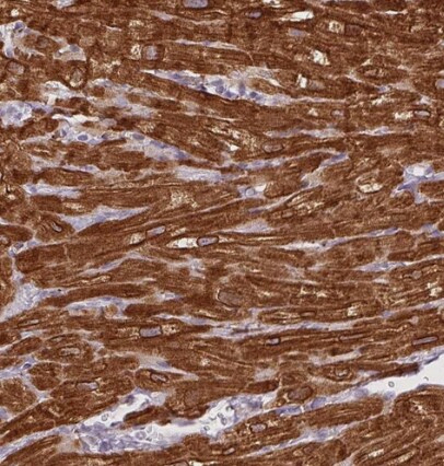 HRC Antibody