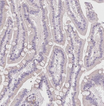 HRC Antibody