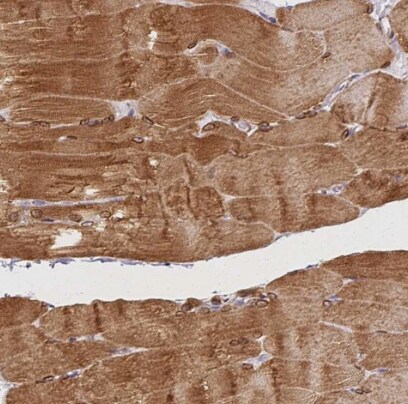 HRC Antibody