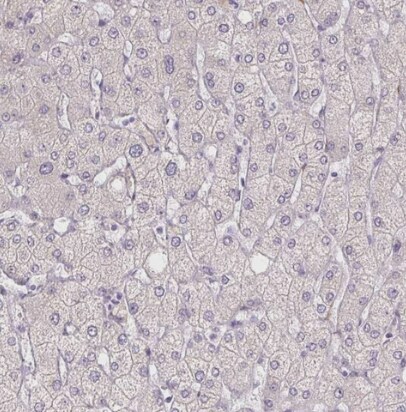 HRC Antibody
