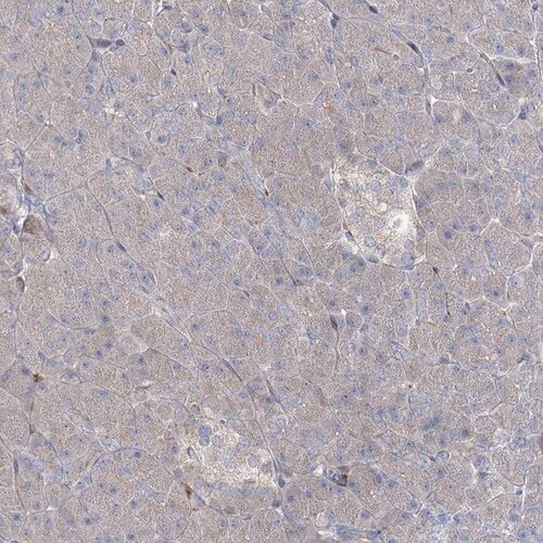 ALKBH8 Antibody - BSA Free Immunohistochemistry-Paraffin: ALKBH8 Antibody [NBP1-81238]