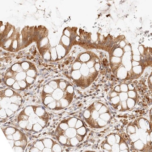 Lyp/PTPN22 Antibody - BSA Free Immunohistochemistry-Paraffin: Lyp/PTPN22 Antibody [NBP1-81277]
