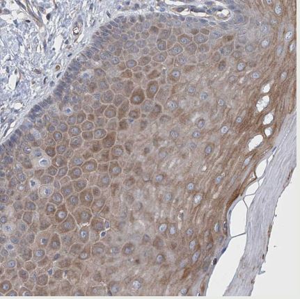 LGTN Antibody
