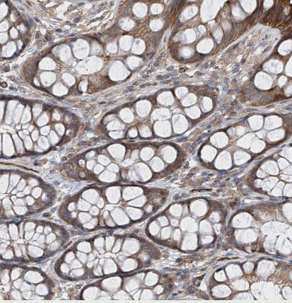 LGTN Antibody