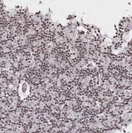 SMIM29 Antibody