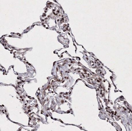 SMIM29 Antibody