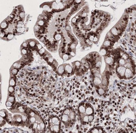 SMIM29 Antibody