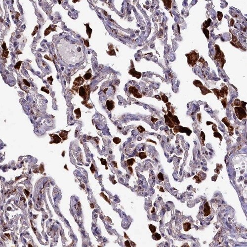 MAN2B1 Antibody - BSA Free Immunohistochemistry-Paraffin: MAN2B1 Antibody [NBP1-81326]