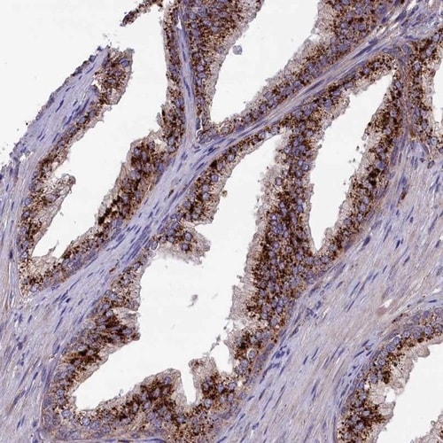 MAN2B1 Antibody - BSA Free Immunohistochemistry-Paraffin: MAN2B1 Antibody [NBP1-81326]