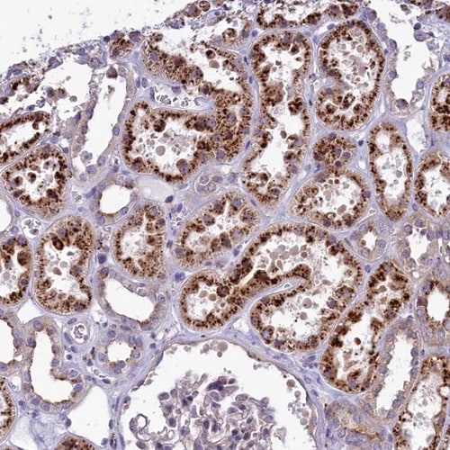 MAN2B1 Antibody - BSA Free Immunohistochemistry-Paraffin: MAN2B1 Antibody [NBP1-81326]