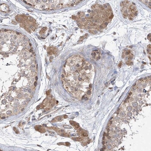 RPL34 Antibody - BSA Free Immunohistochemistry-Paraffin: RPL34 Antibody [NBP1-81331]