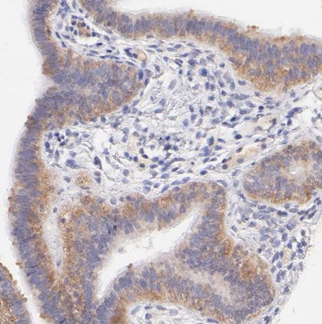 RPL11 Antibody