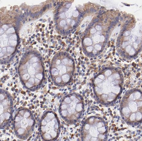 RPL11 Antibody