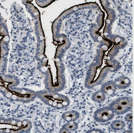 Kv3.3 Antibody