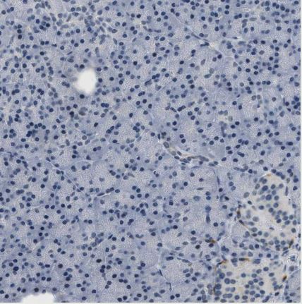 Kv3.3 Antibody