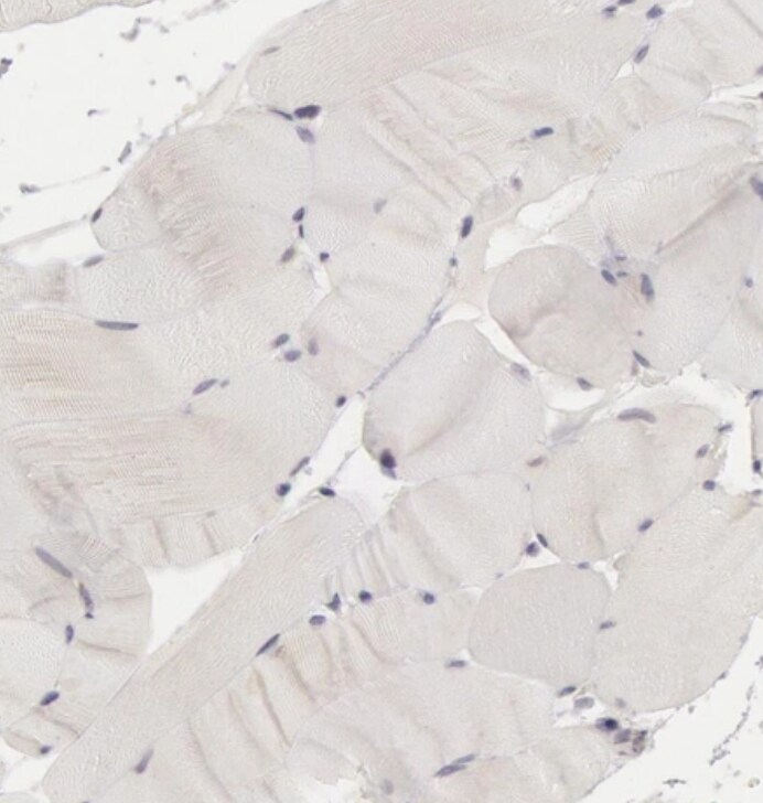 RIMBP3 Antibody - BSA Free