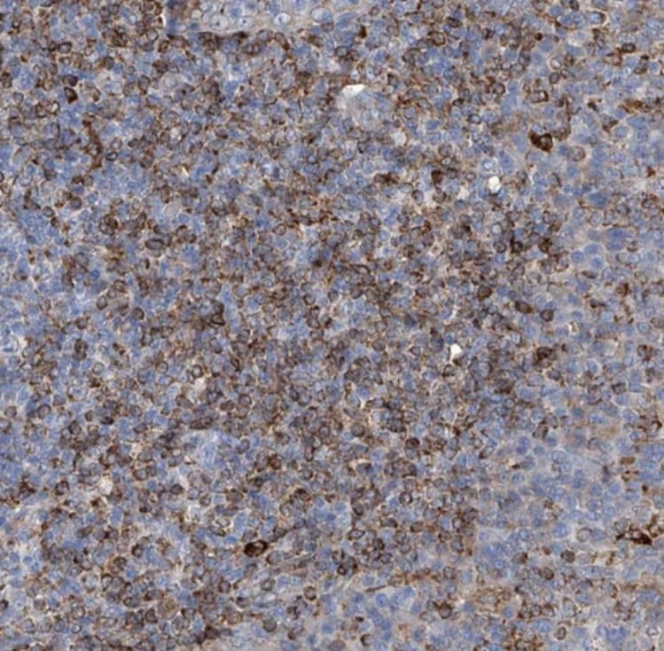UBOX5 Antibody - BSA Free