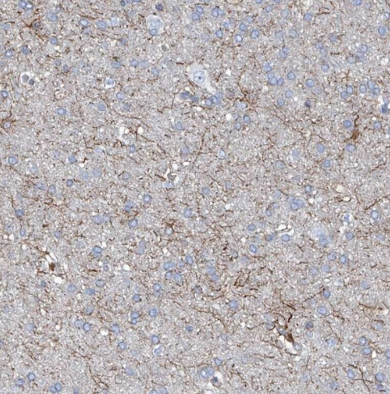 UBOX5 Antibody - BSA Free