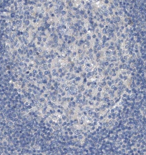 KLHDC10 Antibody - BSA Free
