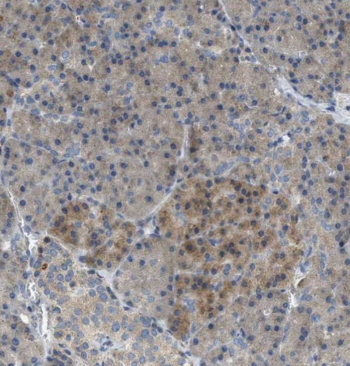KLHDC10 Antibody - BSA Free