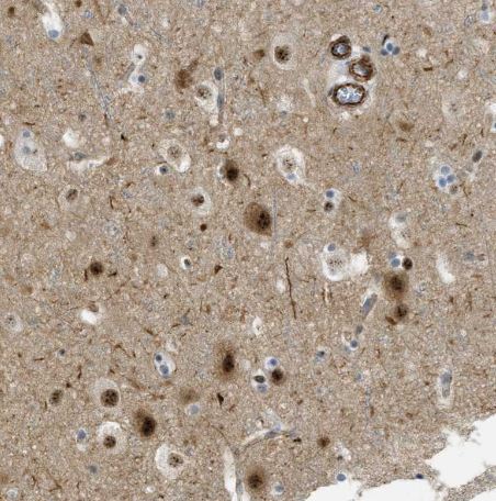LRRC8B Antibody