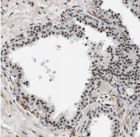 LRRC8B Antibody