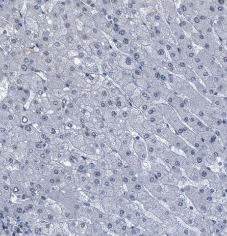 LRRC8B Antibody