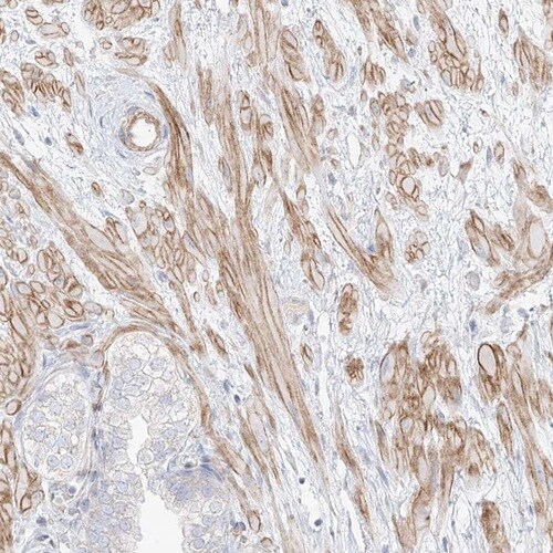 ITPKB Antibody - BSA Free Immunohistochemistry-Paraffin: ITPKB Antibody [NBP1-81589]