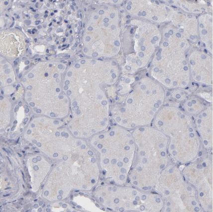 IRF8 Antibody