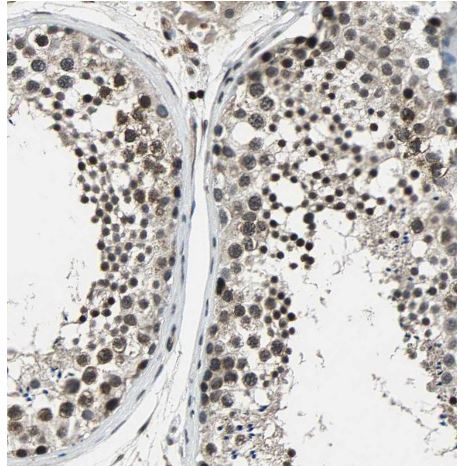TR4/NR2C2 Antibody