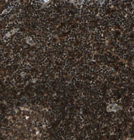 TR4/NR2C2 Antibody