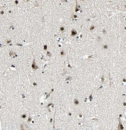 TR4/NR2C2 Antibody