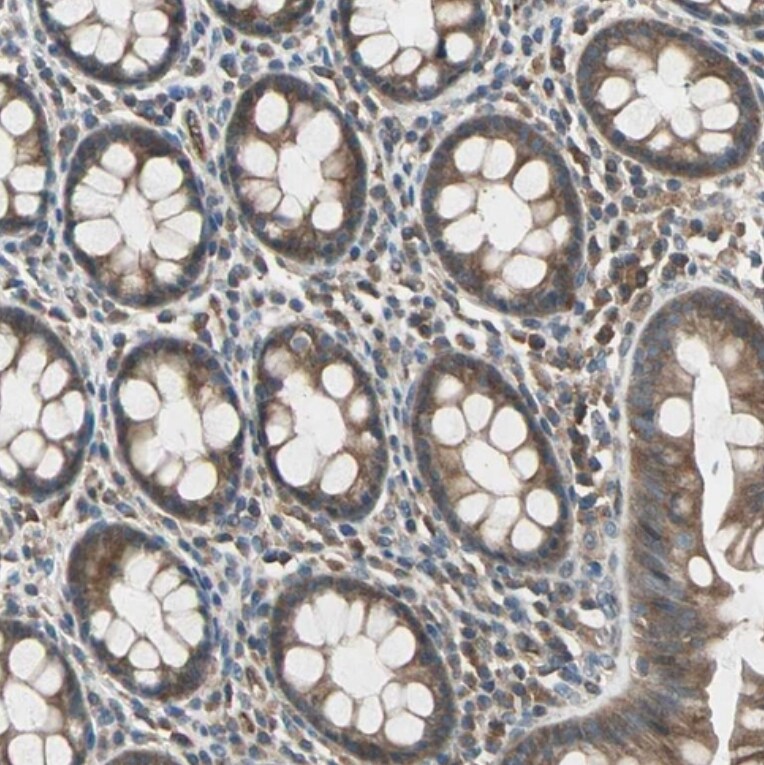 Glucokinase/GCK Antibody - BSA Free