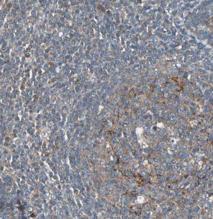Glucokinase/GCK Antibody - BSA Free