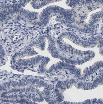 CREM Antibody