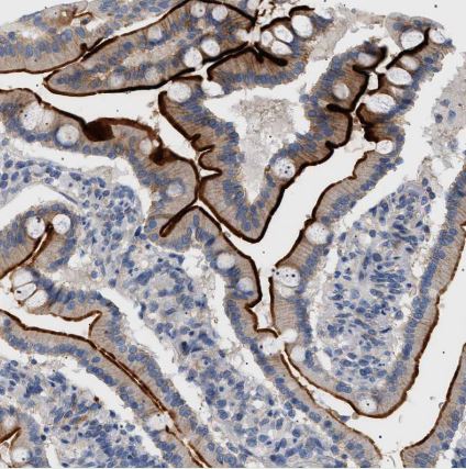 ADCY10 Antibody