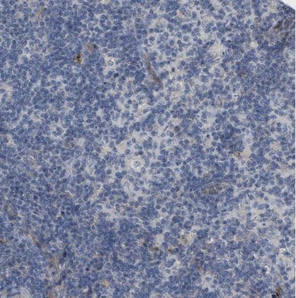 ADCY10 Antibody