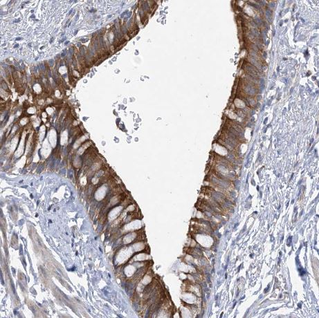CLEC16A Antibody