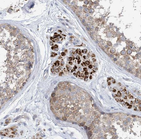 CLEC16A Antibody