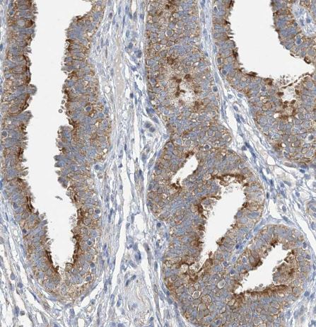 CLEC16A Antibody